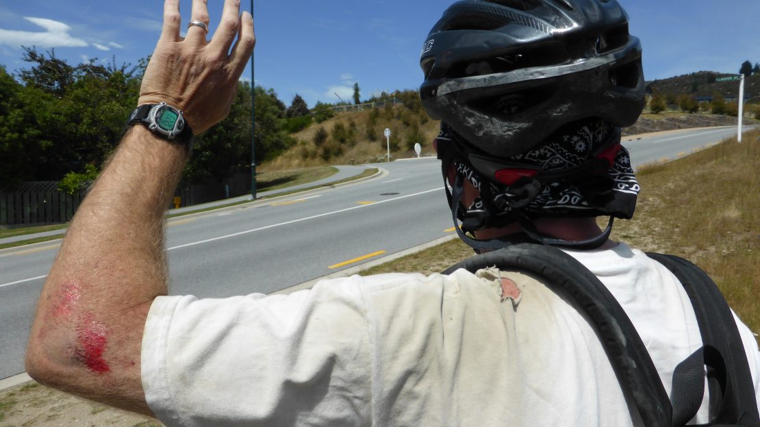 Bloody elbow and torn shirt from bike wreck